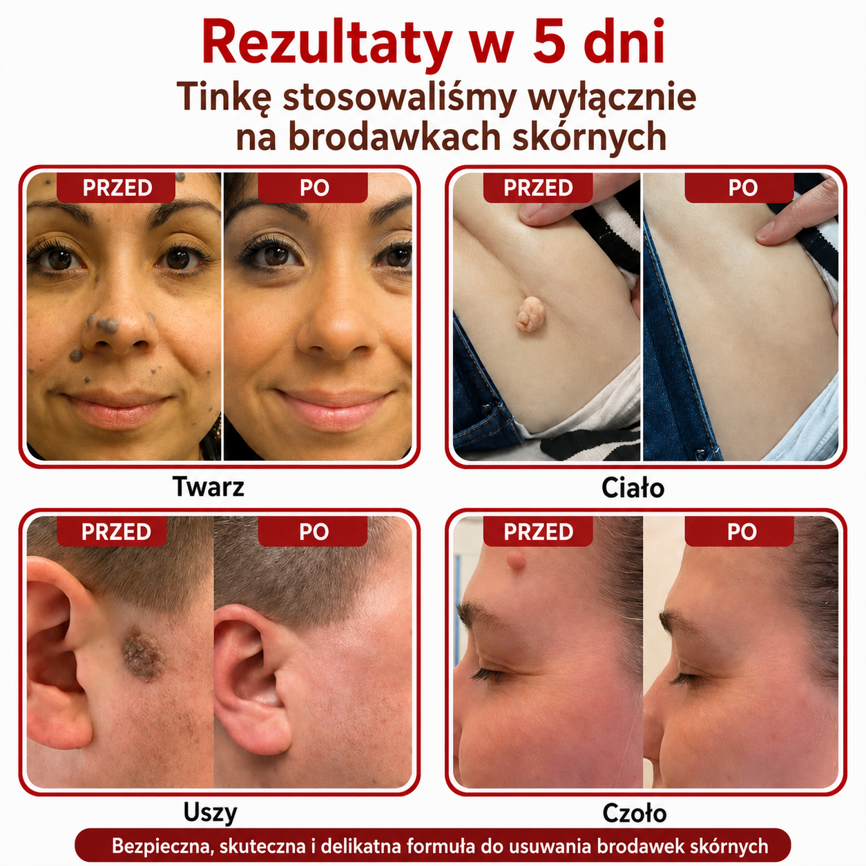 Plaster usuwający GFOUK