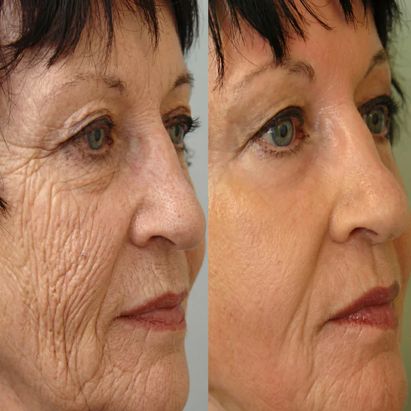 Julie Cosmétique™ senėjimą stabdantis serumas