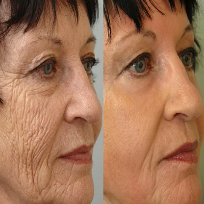 Julie Cosmétique™ senėjimą stabdantis serumas