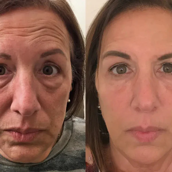 Julie Cosmétique™ senėjimą stabdantis serumas